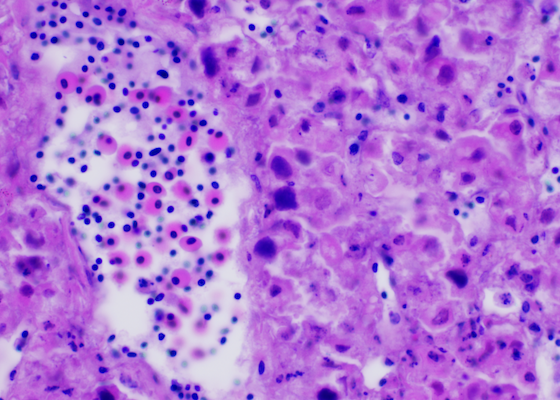 The Truth About Adenovirus in Bearded Dragons